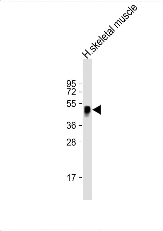 WNT11 Antibody (aa166-198)