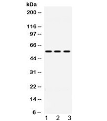 Polyclonal Rabbit anti-Human ALDH1B1 Antibody (WB)