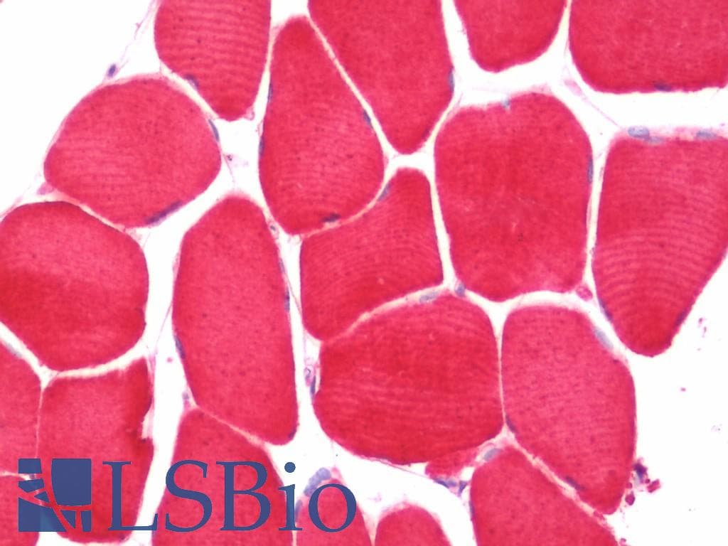 IHC-plus™ ACTC1 / Alpha Cardiac Actin Antibody (aa99-354)