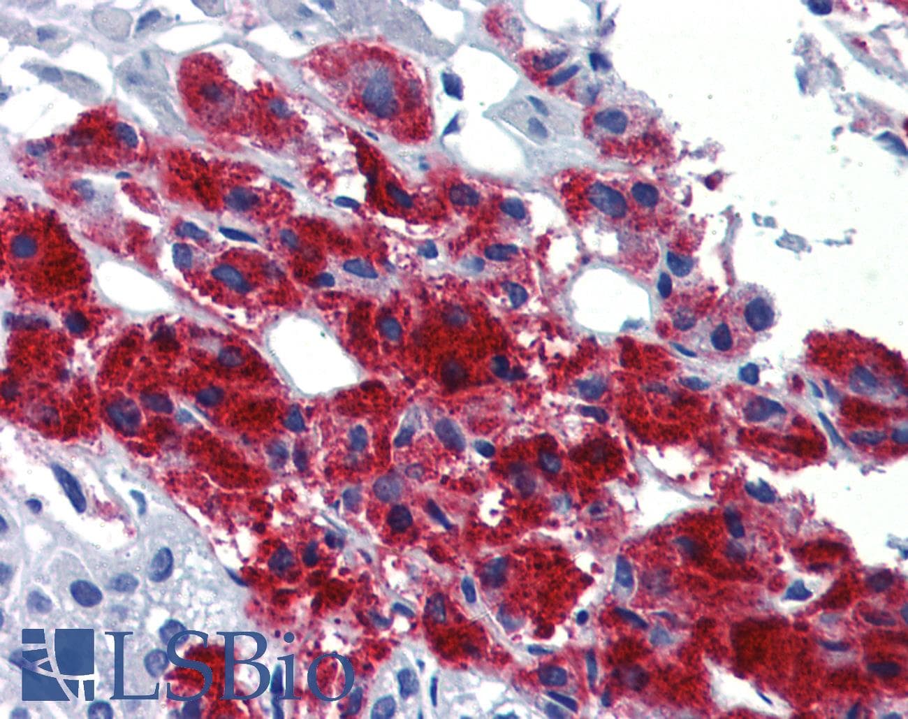 PathPlus™ EGR2 Antibody (aa397-446)