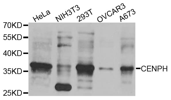 CENPH / CENP-H Antibody