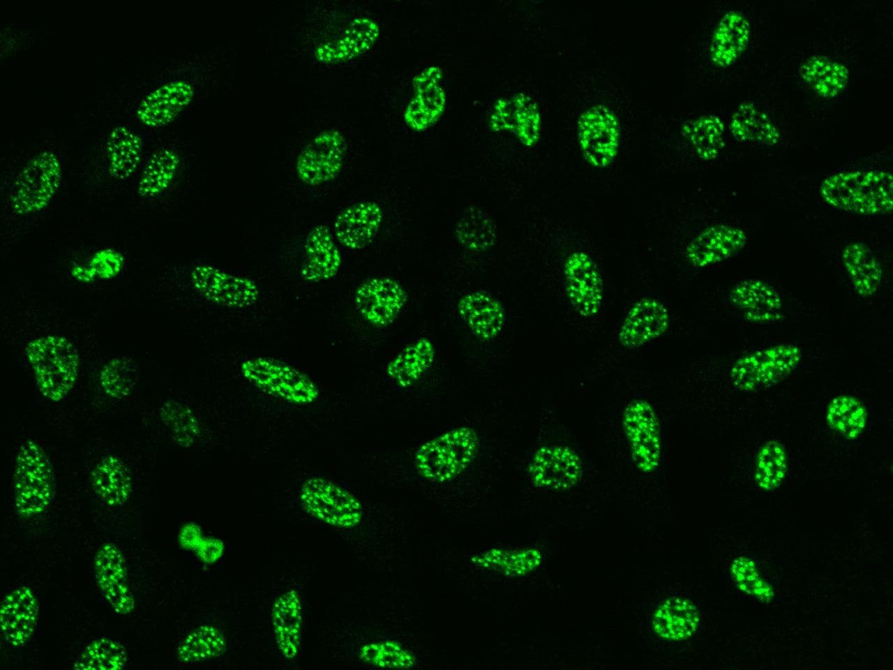 Polyclonal Rabbit anti-Human SRRM2 Antibody (IF)