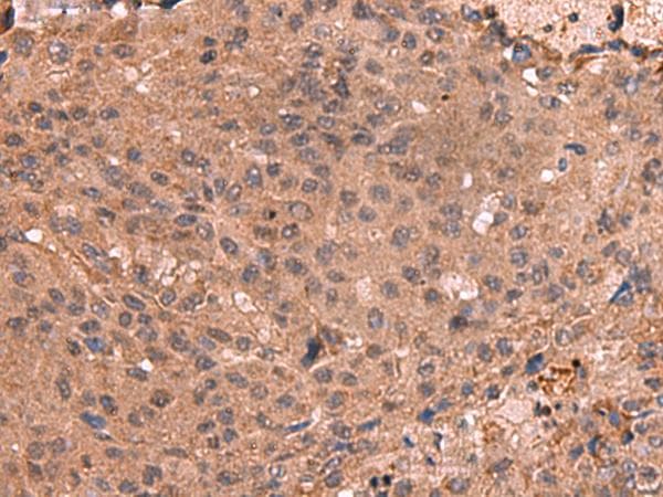 Polyclonal Rabbit anti-Human IST1 Antibody (IHC, WB)