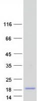 Human KRTAP3-3 Protein (Recombinant Myc-DDK (Flag))