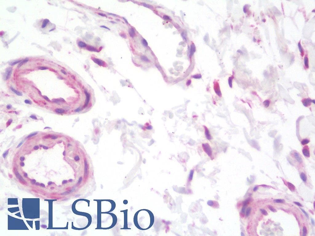 PathPlus™ VEGFA / VEGF Antibody (N-Terminus)