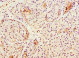 Polyclonal Rabbit anti-Human UBXD9 / ASPL Antibody (IHC, WB)