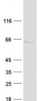 Human CCDC7 / C10orf68 Protein (Recombinant Myc-DDK (Flag))