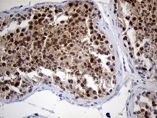 RACGAP1 / MGCRACGAP Antibody (aa123-238, clone OTI4C5)