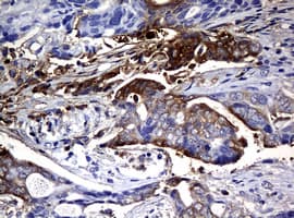 NME1 / NM23 Antibody (clone OTI4G3, Carrier-free)