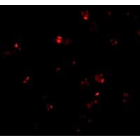 Polyclonal Rabbit anti-Human PSENEN / PEN-2 Antibody (IF, WB)