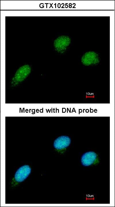 CTBP2 Antibody (aa197-417)