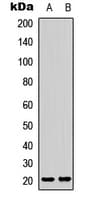 LAIR2 / CD306 Antibody (Internal)
