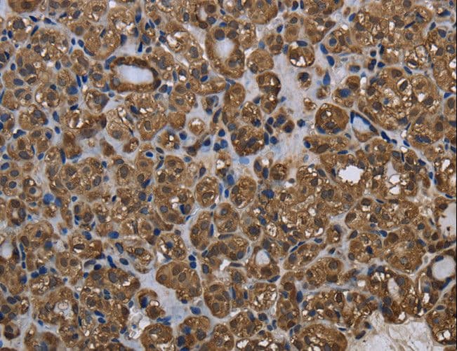 Polyclonal Rabbit anti-Human GSTP1 / GST Pi Antibody (IHC, WB)