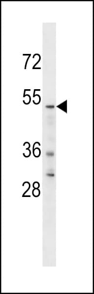 Polyclonal Rabbit anti-Human YTHDF2 Antibody (aa551-579, WB)