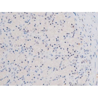 STAT3 Antibody (phospho-Ser727)