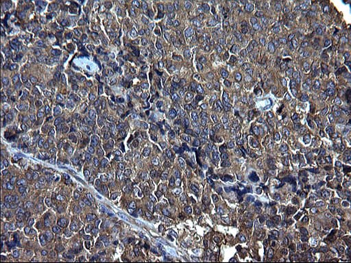 FNDC8 Antibody (clone OTI1C10)