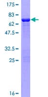 Human CNN3 Protein (Recombinant GST)