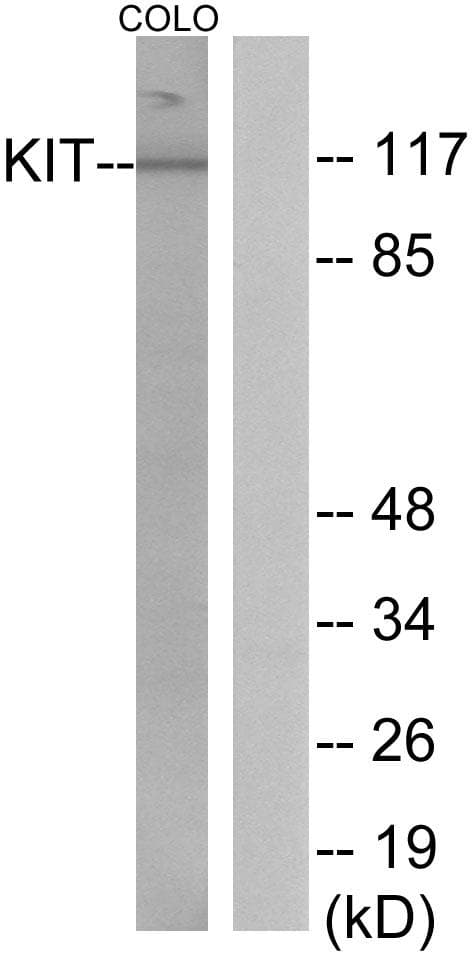 c-Kit / CD117 Antibody (p936)