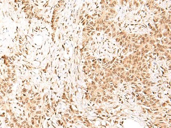 HIST1H1E Antibody