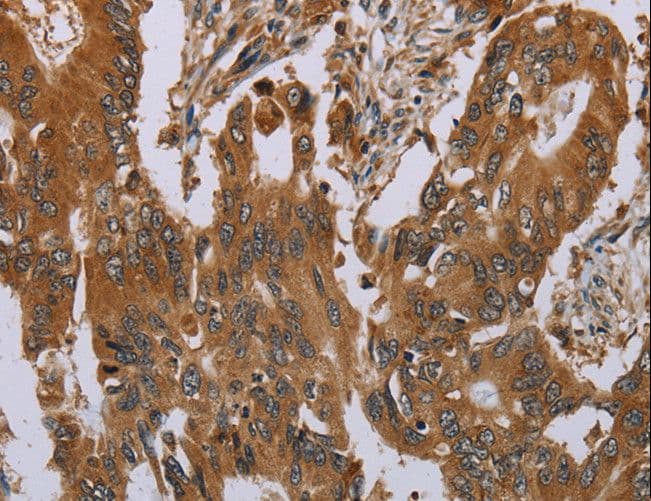 OSM / Oncostatin M Antibody