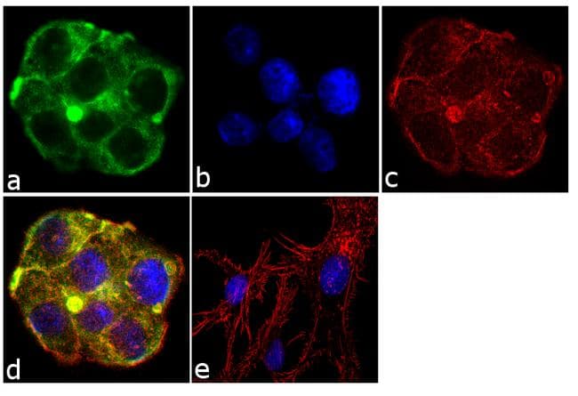 SERPINA1 / Alpha 1 Antitrypsin Antibody (clone TMF1#4B5)
