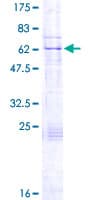 Human KATNA1 Protein (Recombinant GST)