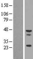 TMOD4 Protein (Over-Expression Lysate Myc-DDK (Flag))