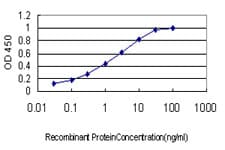 Monoclonal Mouse anti-Human TIP120 / CAND1 Antibody (clone 5D7, IHC, IF, WB)