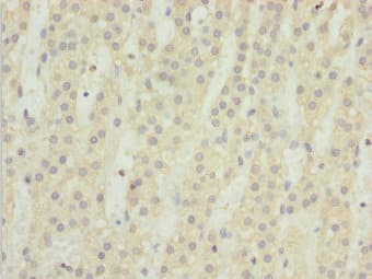 Polyclonal Rabbit anti-Human TM9SF1 Antibody (IHC, IF, WB)