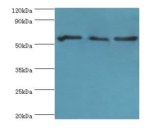 PDHX / Protein X / ProX Antibody (aa1-300)