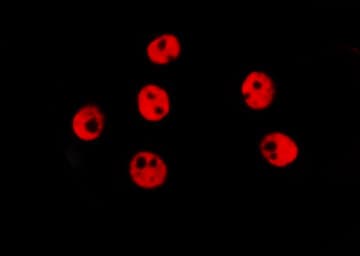 TAL1 Antibody