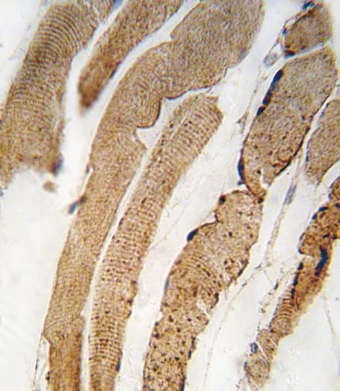Polyclonal Rabbit anti-Human PDK4 Antibody (aa83-111, IHC, IF, WB)