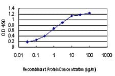 IHC-plus™ LIMK1 / LIMK Antibody (clone 1A8)