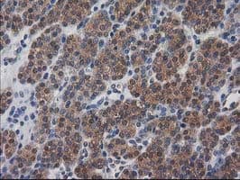 DSTN / Destrin Antibody (clone OTI1D5)