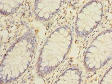 Polyclonal Rabbit anti-Human CEP76 Antibody (IHC, WB)