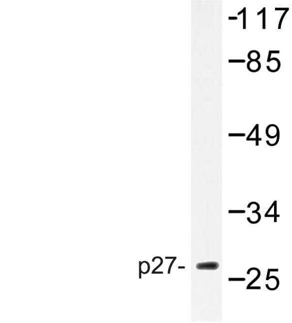 CDKN1B / p27 Kip1 Antibody (Pro191)