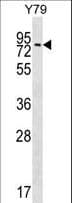 Polyclonal Rabbit anti-Human MAK Antibody (aa578-608, IHC, WB)