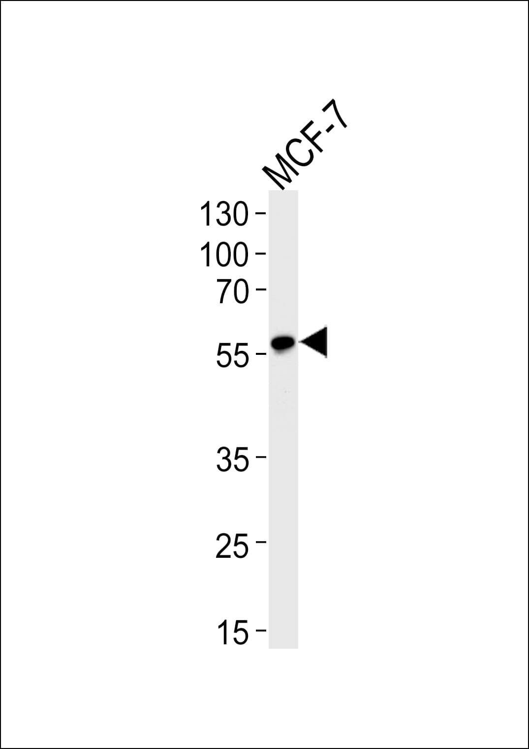 ACVRL1 Antibody (aa11-44)
