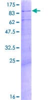 Human MED17 / TRAP80 Protein (Recombinant GST)