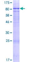 Human ADAD2 Protein (Recombinant GST)