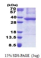 Human ASB8 Protein (Recombinant His)