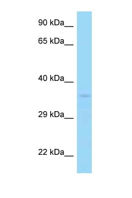 Polyclonal Rabbit anti-Human PP2Ac / PPP2CA Antibody (aa23-72, WB)