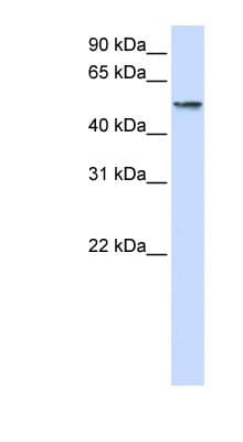 Polyclonal Rabbit anti-Human USP22 Antibody (aa216-265, WB)