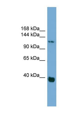 CTNND1 / p120 Catenin Antibody (aa827-876)