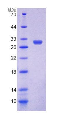 Mouse GP78 / AMFR Protein (Recombinant His-T7)