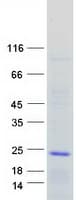 Human PACAP Protein (Recombinant Myc-DDK (Flag))
