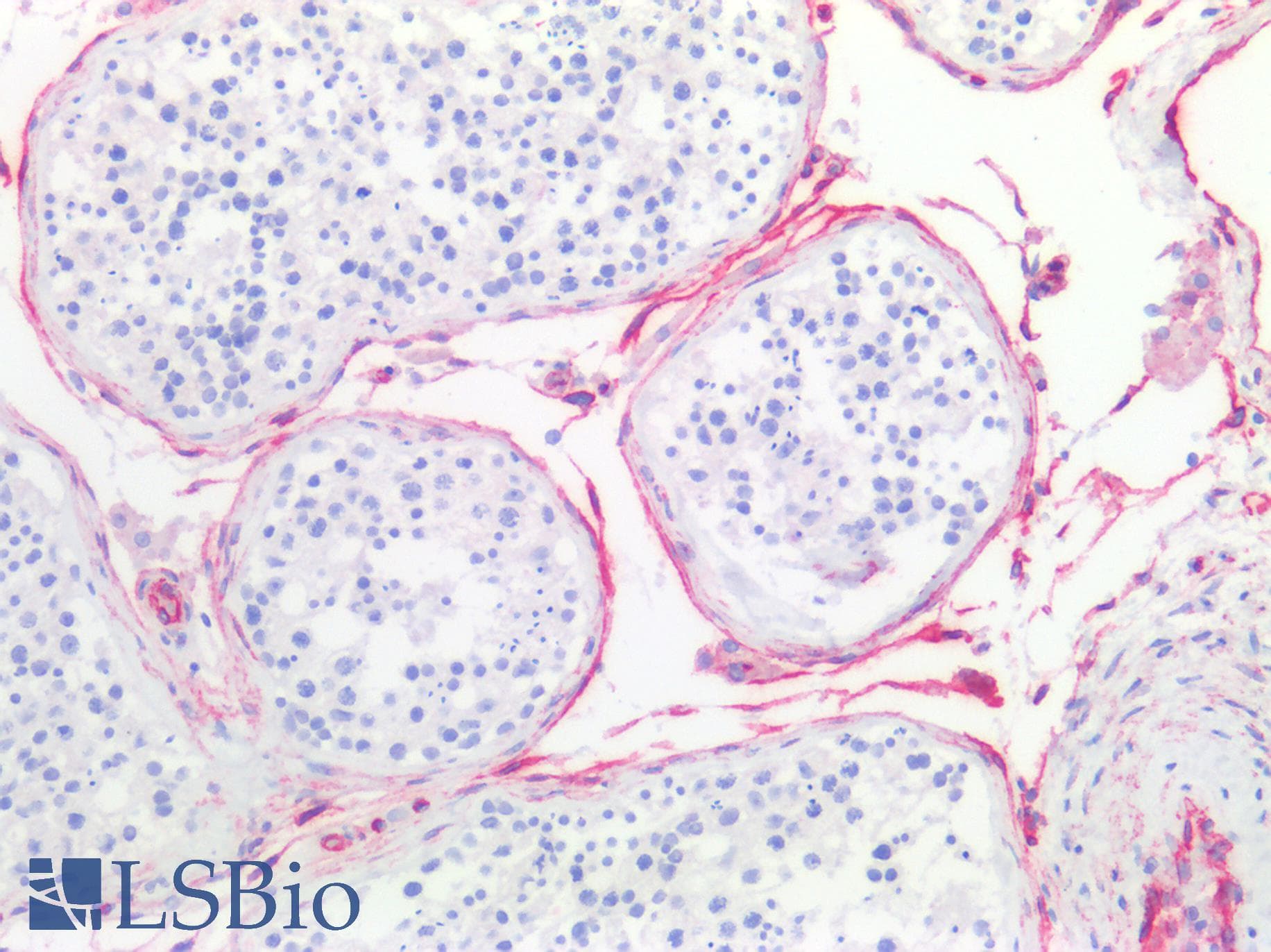 IHC-plus™ CAV1 / Caveolin 1 Antibody