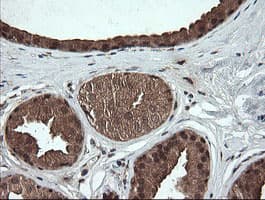 OTUB1 / OTU1 Antibody (clone OTI5F7)