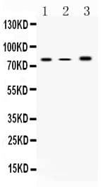 ALOX12 / 12 Lipoxygenase Antibody