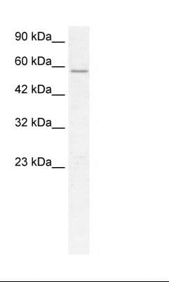 GABRD Antibody (N-Terminus)